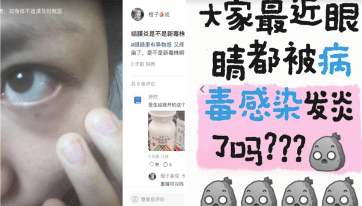 疫情,症状,眼睛,红肿,新冠,变异,毒株