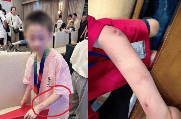朱宏鑫,围棋,天才,坠楼,家暴,轻生