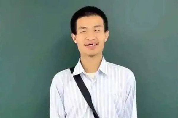 无论校方或善意想保护他的人，越过其主观意愿，做太多“为你好”的干涉或安排，可能都不是很合适。
—— 文 | 张彦宗