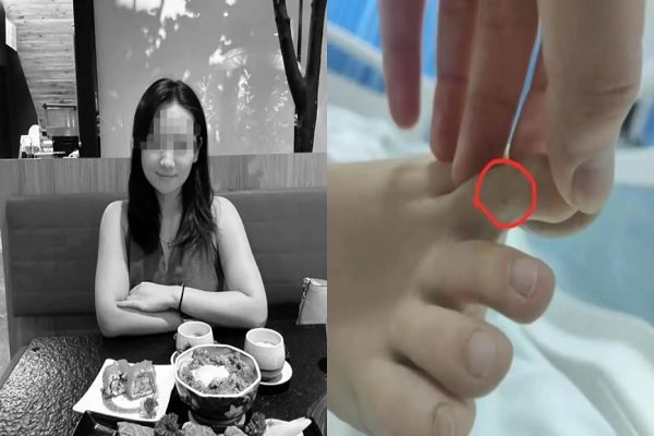 2025年6月4日，27岁中国女子在三亚疑遭蛇咬，不治身故。（网络撷图合成）