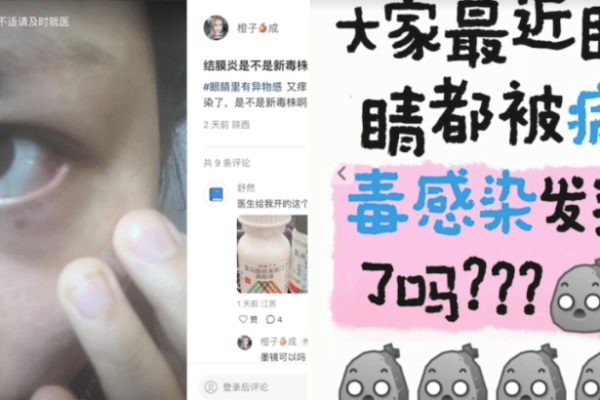 疫情,症状,眼睛,红肿,新冠,变异,毒株