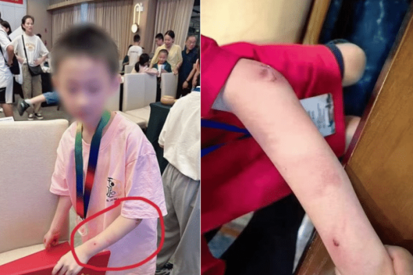 朱宏鑫,围棋,天才,坠楼,家暴,轻生